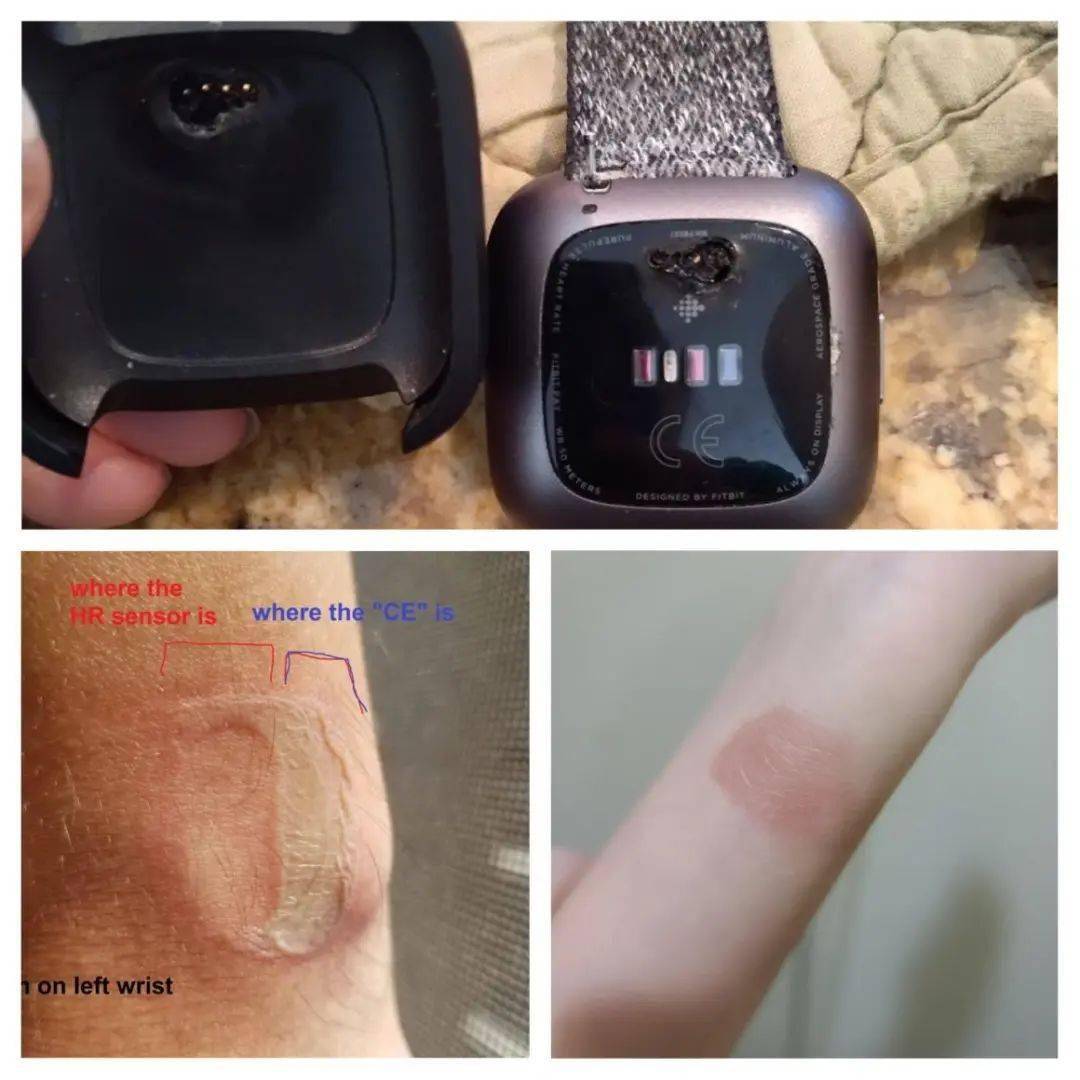 fitbit下载苹果版fitbitapp登录不上